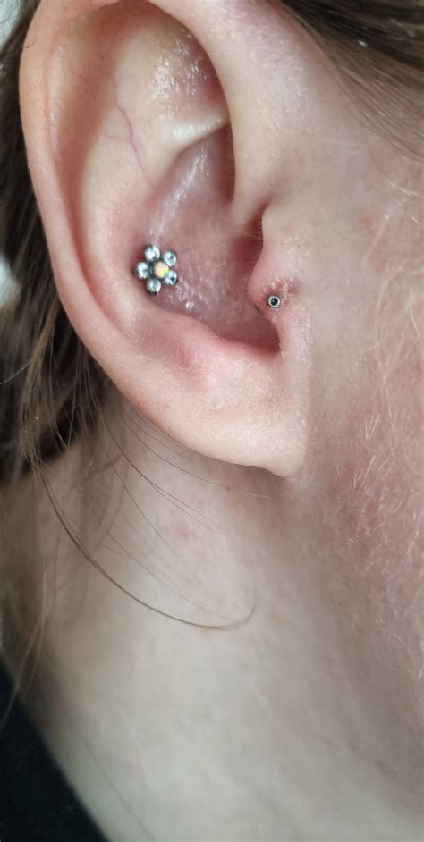 Can a piercing reject after 2 years?